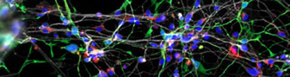 Cultivo de neuronas procedentes de dientes de leche de niños con síndrome de Williams