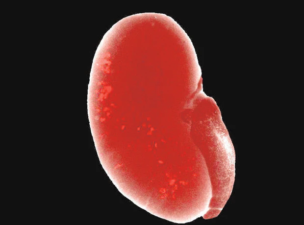 Un riñón con las nuevas nefronas integradas(en rojo)