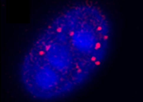 ARNm de la huntingtina (rojo) en el núcleo de una fibra muscular esquética de un ratón con la enfermedad