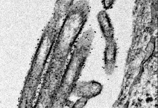 Células pulmonares humanas infectadas por la cepa OE4