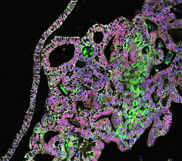 Imagen al microscopio del tejido estomacal creado en el laboratorio del Hospital Infantil de Cincinnati