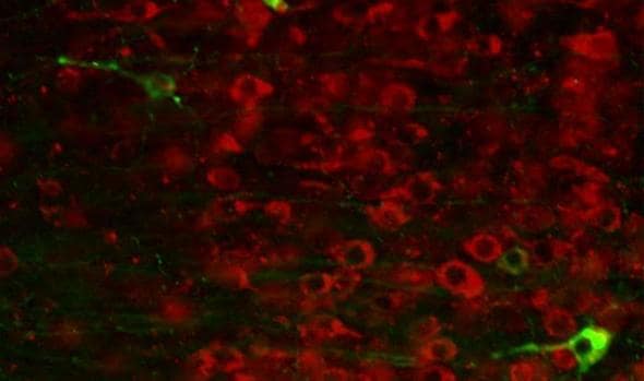 Ausencia de ovillos neurofibrilares (en verde) en las neuronas con el nuevo fármaco (en rojo)