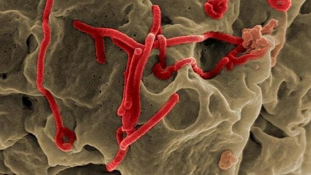 Virus del ébola (en rojo)