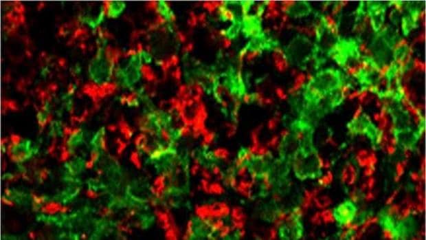 Restauración de la formación de mielina (en rojo) en la médula espinal de un ratón tratado con miR-219