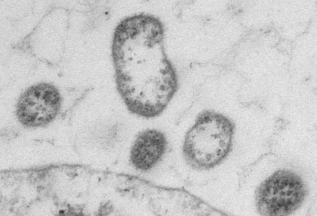 LCMV modificado con proteínas tumorales integradas