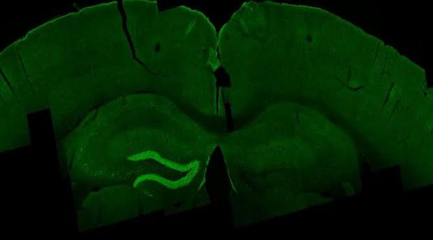 Estimulación con la ETI del hipocampo (en verde) de un ratón
