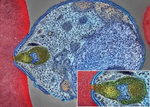 Imagen por microscopía electrónica de un merozoito unido a la membrana de un eritrocito