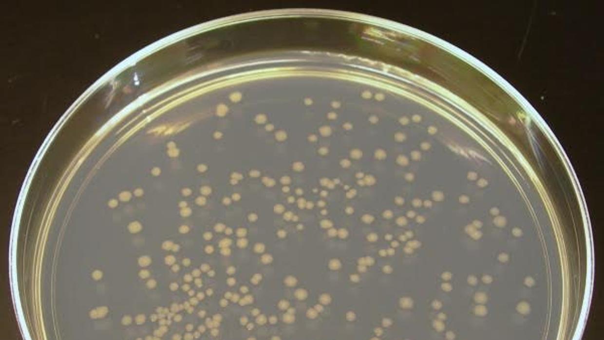 Cultivo bacteriano en una placa de laboratorio