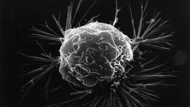 Célula de cáncer de mama