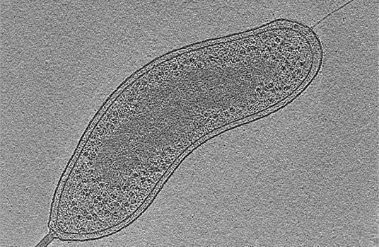 Bacterias depredadoras podrían mejorar la función pulmonar en la fibrosis quística