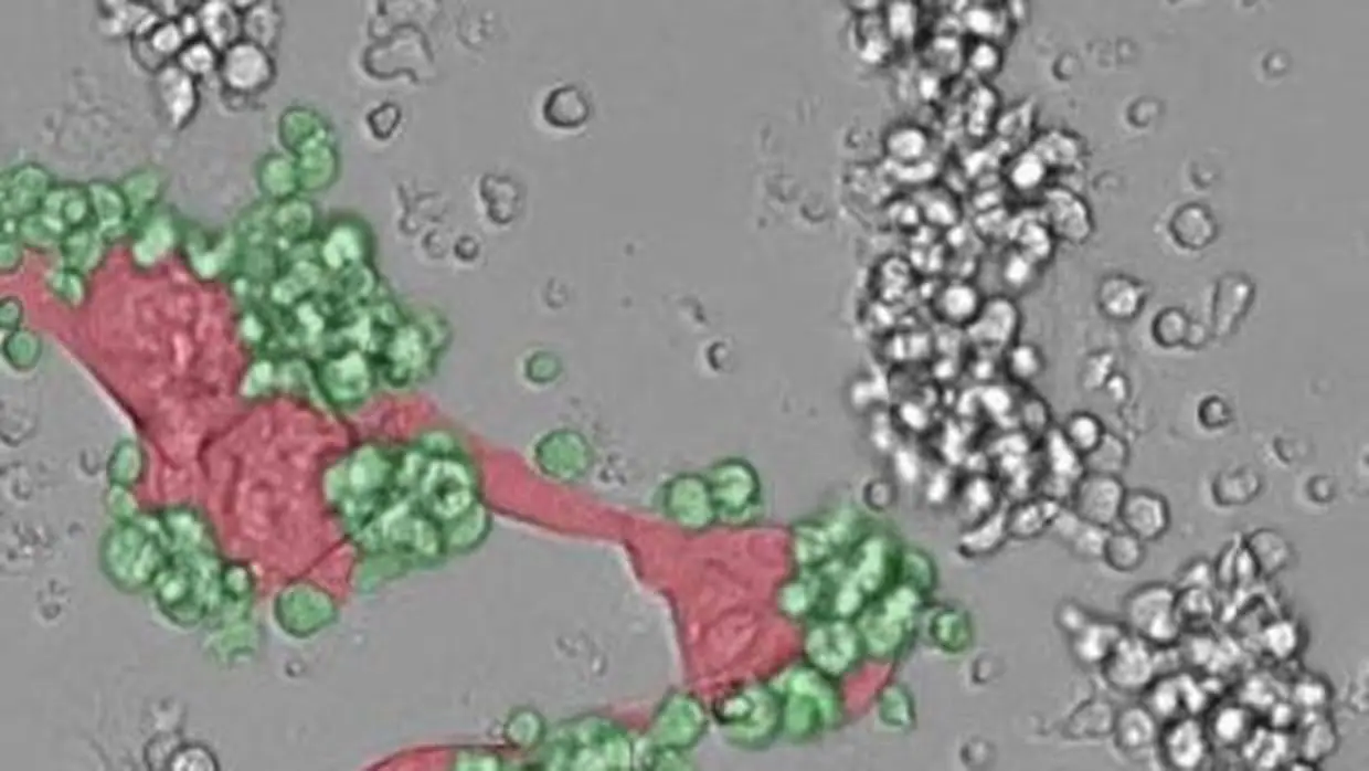 Macrófagos (verde) atacando a las células tumorales