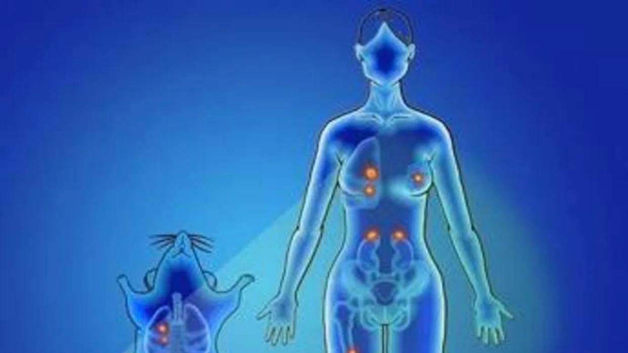 Ilustración que muestra la señalización de un cáncer de mama y sus metástasis