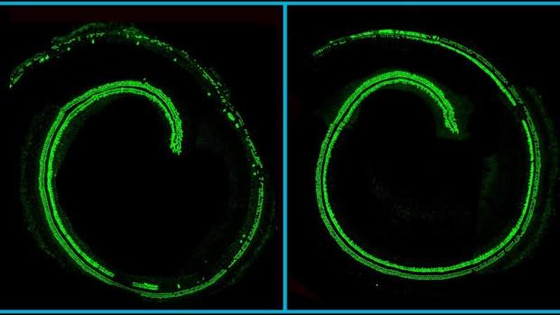 El ‘corta-pega genético’ podría evitar numerosos casos de sordera