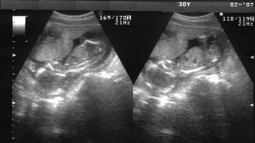 Los 10 estudios biomédicos &#039;trending topic&#039; de 2017