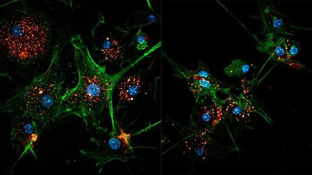 Inmunoterapias más sofisticadas y potentes frente al cáncer