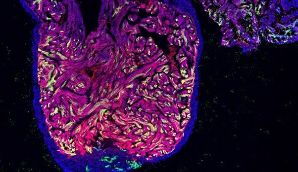 Describen un mecanismo por el que las
células cardiacas del pez cebra regeneran el
corazón