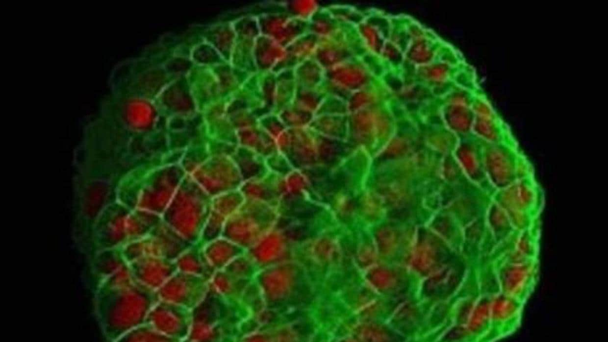 Cultivo tridimensional de células de cáncer de mama