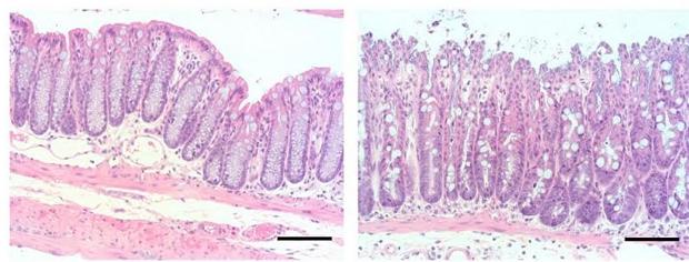 HIC1, la proteína que podría curar el síndrome del intestino irritable