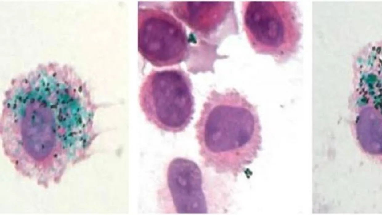 Pigmento verde de tatuaje capturado por un macrófago (izquierda), liberado tras su muerte (centro) y recapturado por otro macrófago (derecha)