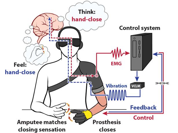 Descubren la forma de restaurar la sensación de movimiento en pacientes amputados