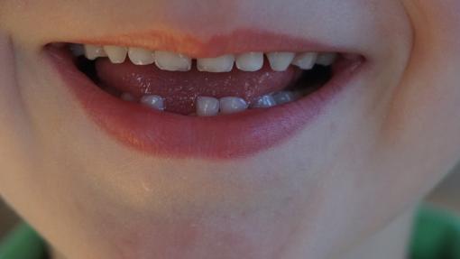 Diez falsos mitos sobre la salud de tus dientes