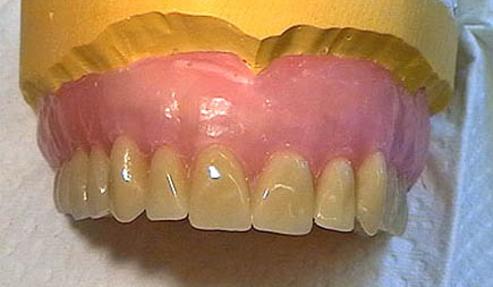 Diez falsos mitos sobre la salud de tus dientes