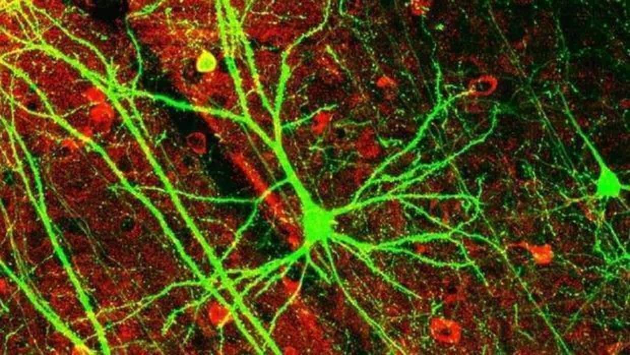 Neuronas cerebrales