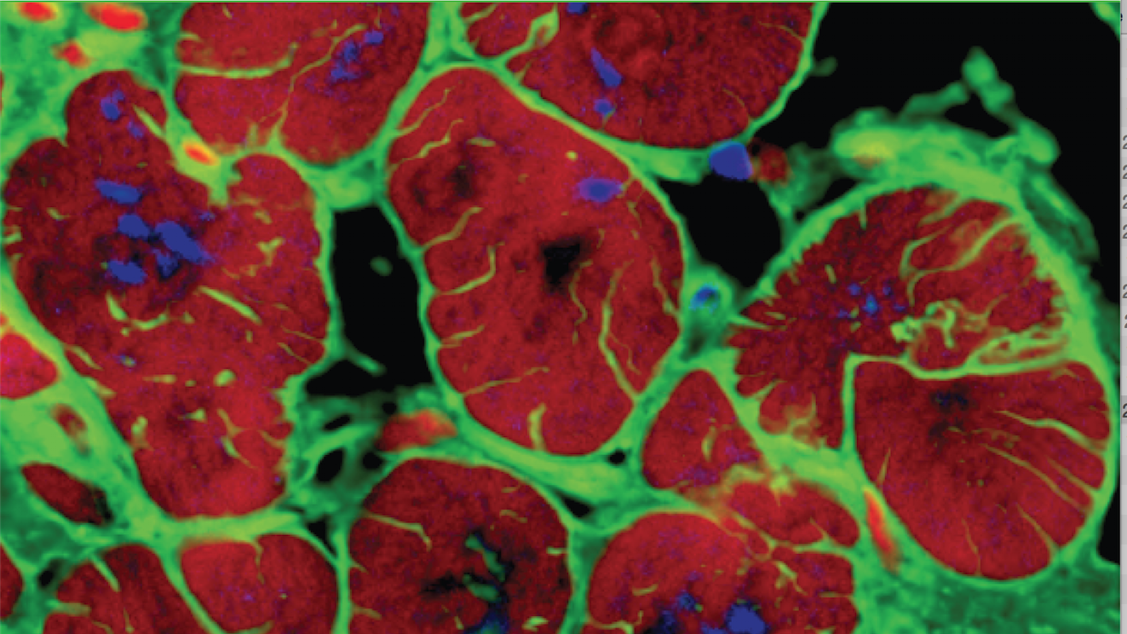 Cardiomiiocitos derivados de células iPS