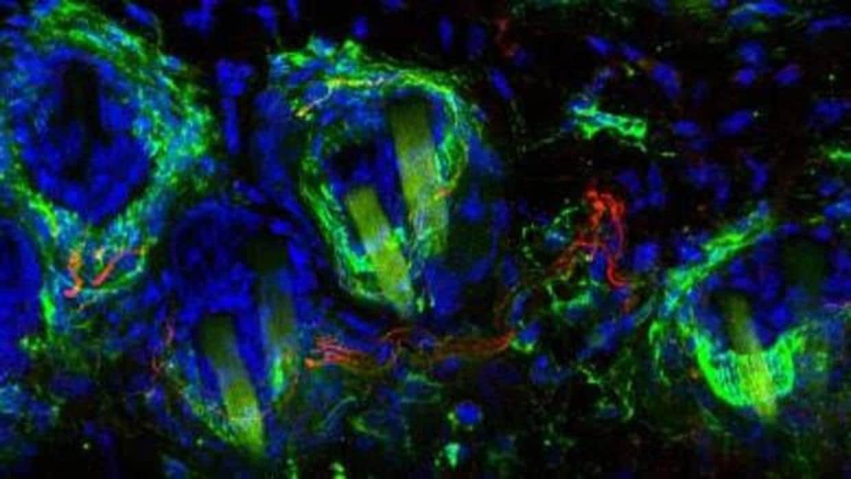 Neuronas responsables de la sensibilidad a los contactos leves en los folículos pilosos (en verde) de un ratón