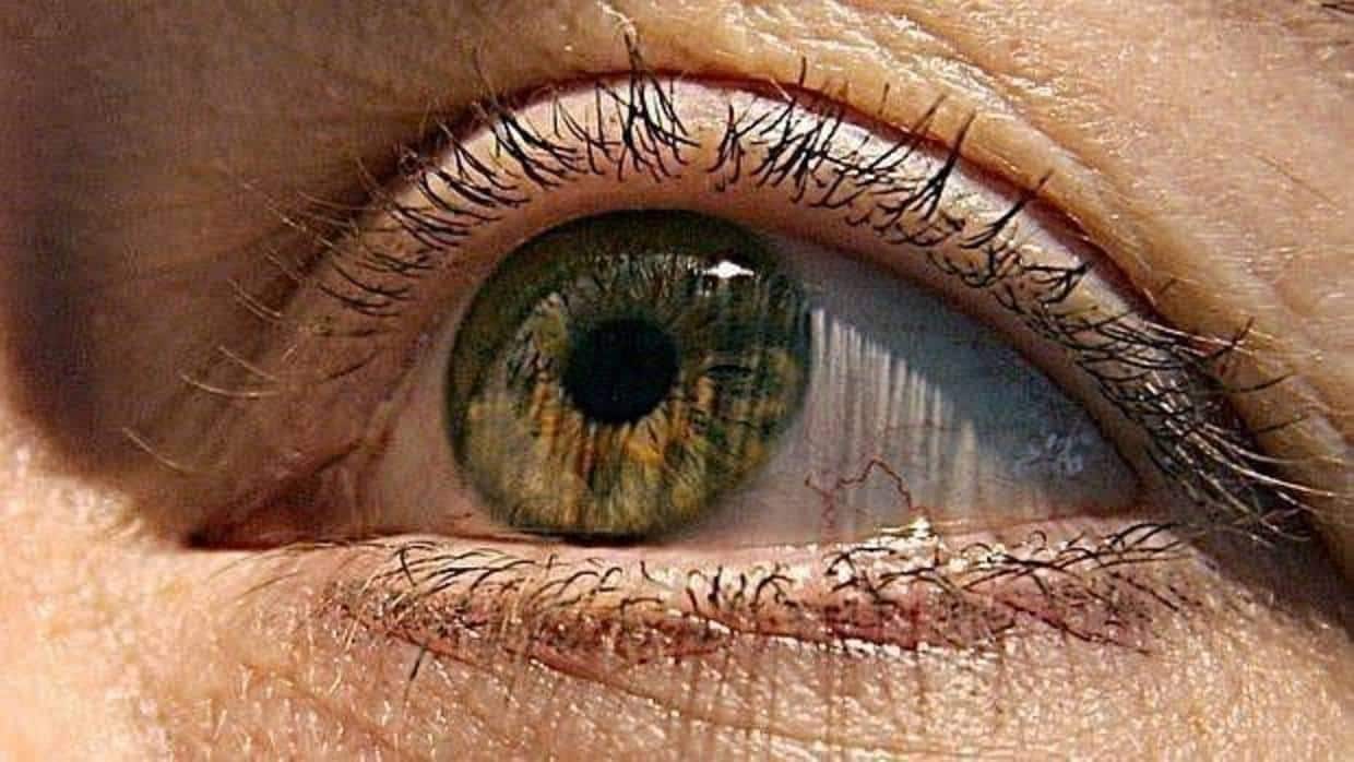Persona afectada por glaucoma