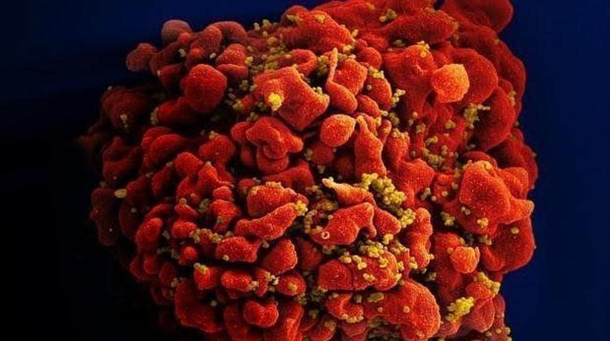Célula infectada por el VIH