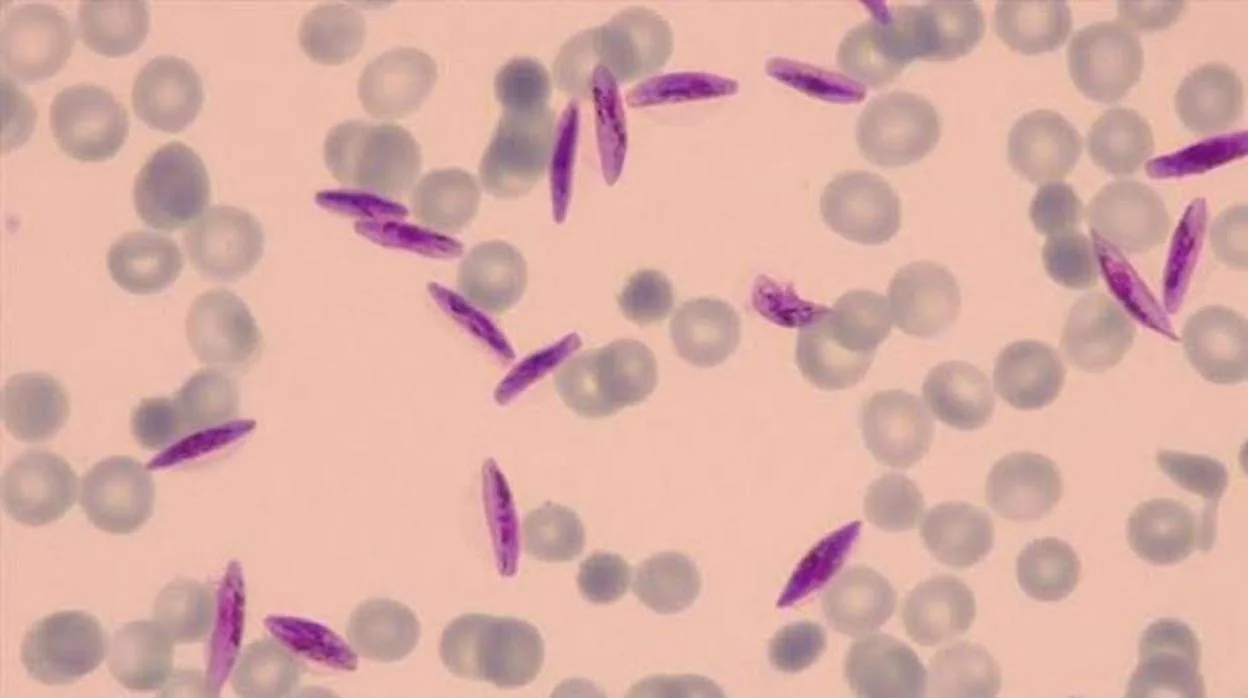 Gametocitos de ‘Plasmodium falciparum’ en eritrocitos humanos