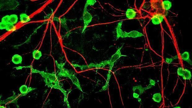 El alzhéimer y el párkinson podrían tener un origen autoinmune