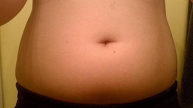 El metaboloma: otra forma de medir los efectos nocivos de la obesidad sobre la salud