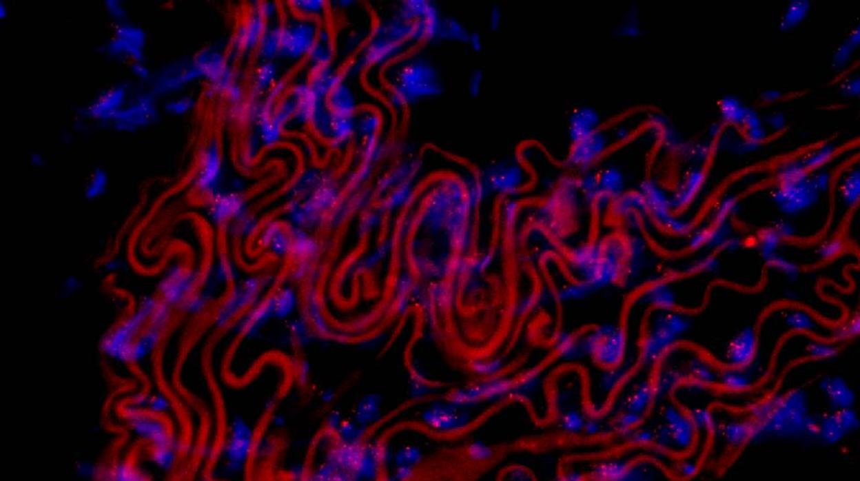 Imagen microcópica de secciones delgadas de una aorta torácica de ratón expuesta a una sonda fluorescente para teñir telómeros