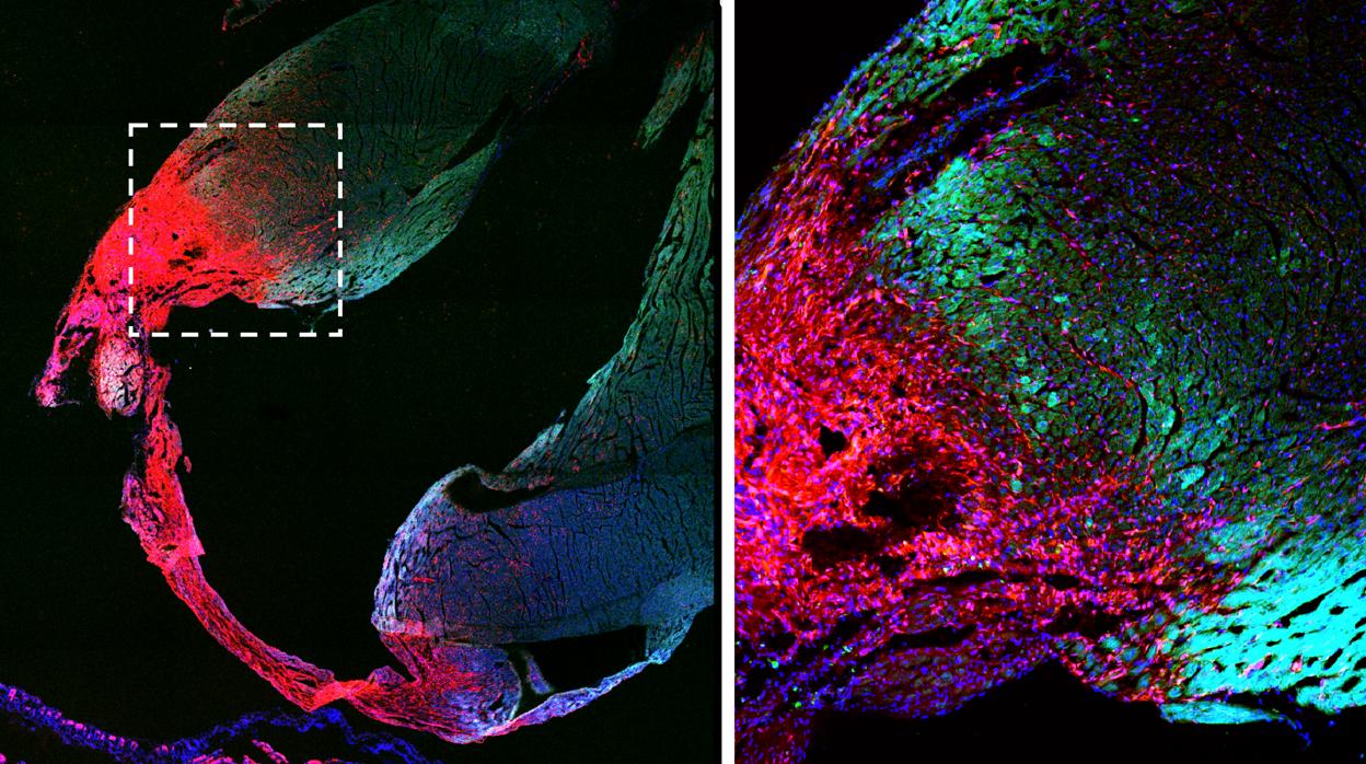 Parte de la pared cardíaca del corazón de ratón después de un infarto de miocardio. Se puede ver el tejido cicatricial (rojo) y las células musculares del corazón muerto (verde).