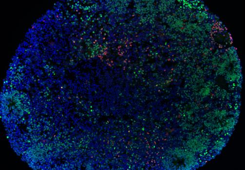 Organoide humano cortical