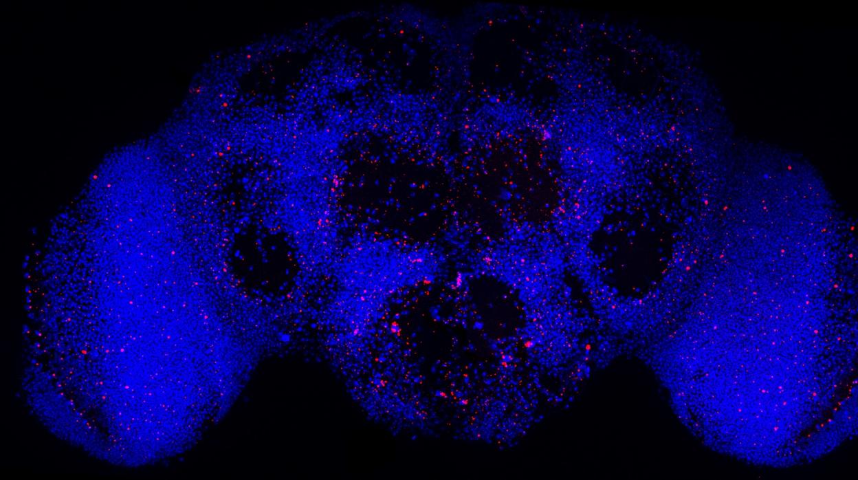 Las neuronas en rojo son las neuronas no aptas que se eliminarían para el mejor funcionamiento de todo el cerebro, marcado en azul