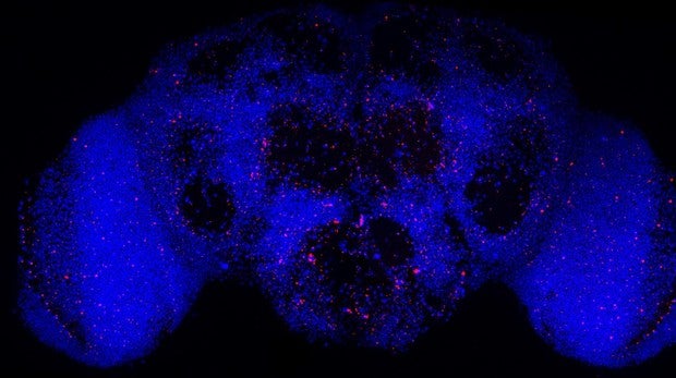 Perder neuronas puede no ser tan malo en el alzhéimer