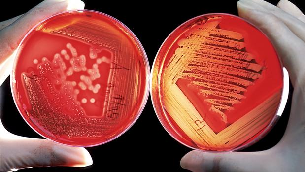 Hallan un vínculo entre las bacterias intestinales y la depresión