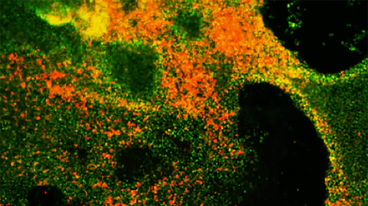 Los progenitores pulmonares (verdes) forman un mayor número de células neuroendocrinas (rojas) cuando se inhiben tanto el gen RB como la vía de señalización