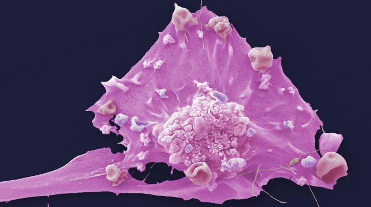 Células del cáncer de Mama