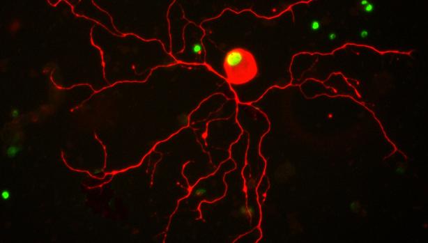 Un estilo de vida activo mejora la capacidad regenerativa del sistema nervioso tras lesión medular