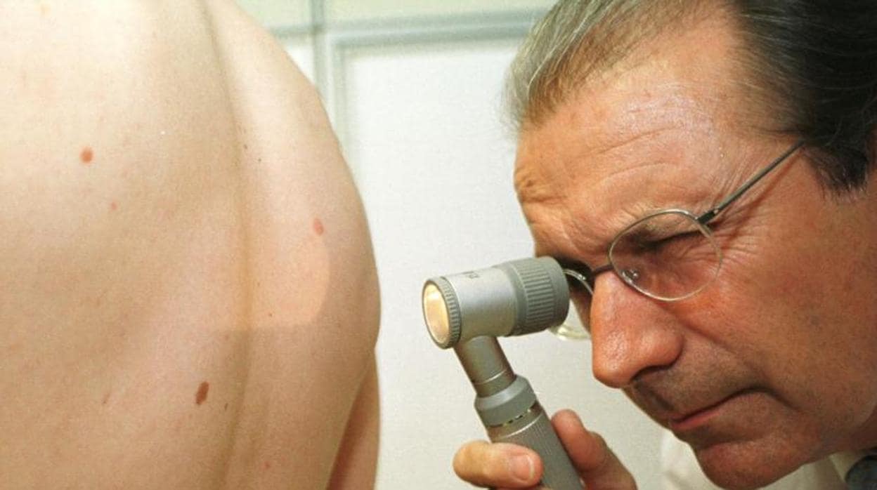 El melanoma es el cáncer de piel más peligroso
