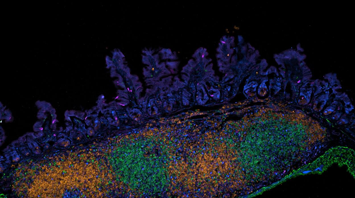 La imagen muestra una imagen de microscopio confocal de células inmunes en el revestimiento epitelial del intestino de un ratón joven.