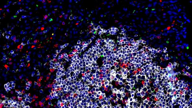 Las células maestras que atacan a la bacteria que causa la tuberculosis