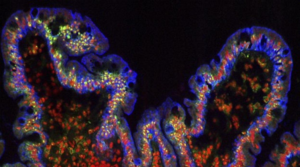 Vellosidades del intestino donde se inserta las heces de la persona sana