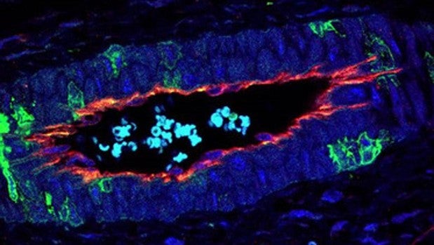 La proteína p38 regula la formación de nuevos vasos sanguíneos en tumores de cáncer de colon