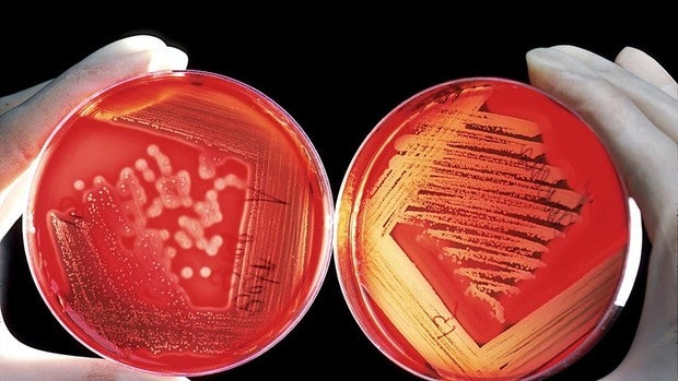 Identifican una proteína clave en la cicatrización y el remodelado cardíaco tras sobrecarga de presión