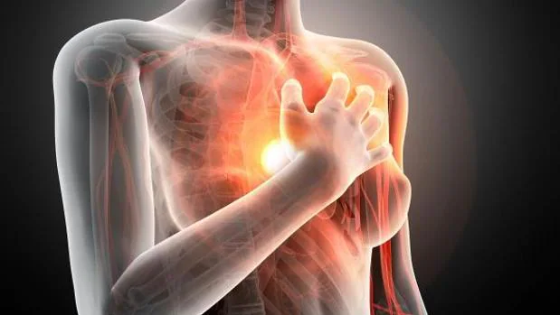 Amiloidosis cardiaca: El raro síndrome del corazón rígido que cada vez se diagnostica más